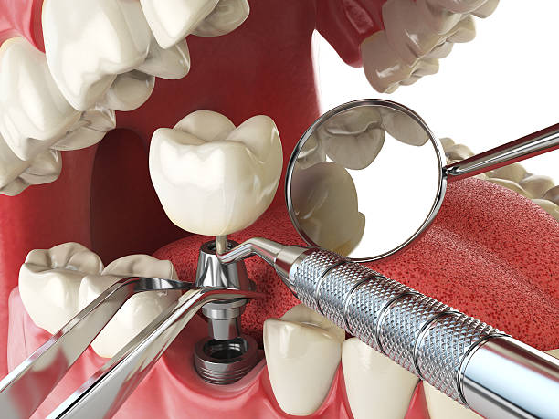 Best Tooth Infection Emergency Dentist  in Montara, CA